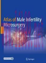 [PDF]Atlas of Male Infertility Microsurgery