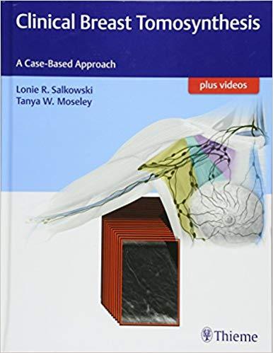 Clinical Breast Tomosynthesis (包含视频)