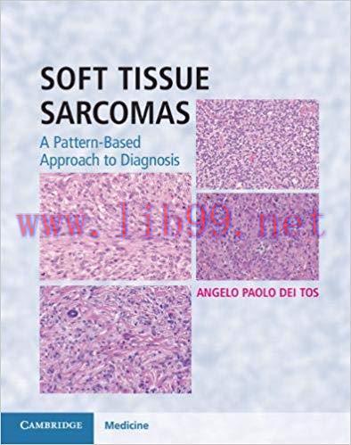 [PDF]Soft Tissue Sarcomas: A Pattern-Based Approach to Diagnosis