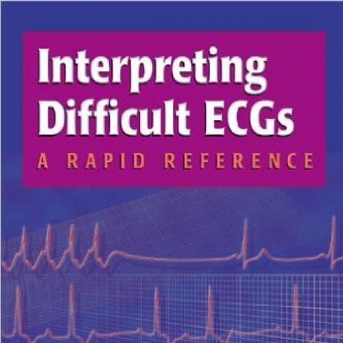 Interpreting Difficult ECGs _ A Rapid Reference