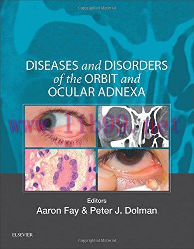 [AME]Diseases and Disorders of the Orbit and Ocular Adnexa, 1e (PDF)