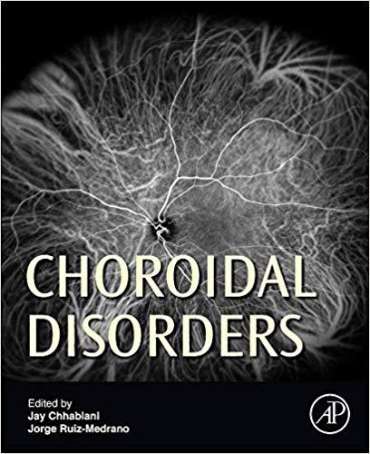 Choroidal Disorders- Academic Press (2017)