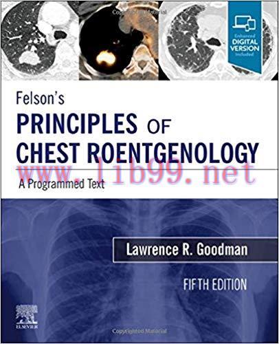 [PDF]Felson’s Principles of Chest Roentgenology: A Programmed Text 5th Editio