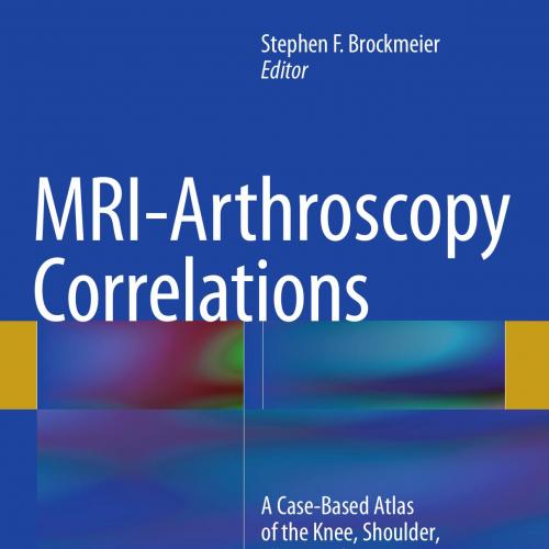 MRI-Arthroscopy Correlations