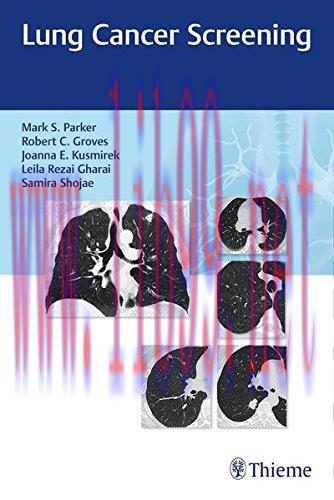 [AME]Lung Cancer Screening (PDF)