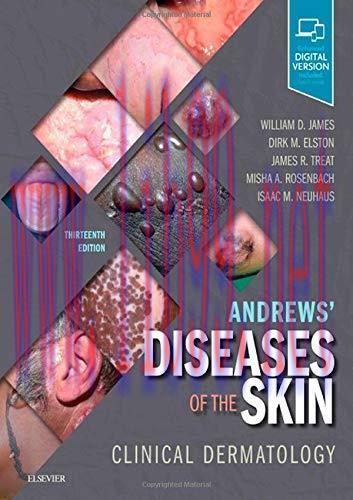 [AME]Andrews' Diseases of the Skin: Clinical Dermatology, 13ed (Original PDF)
