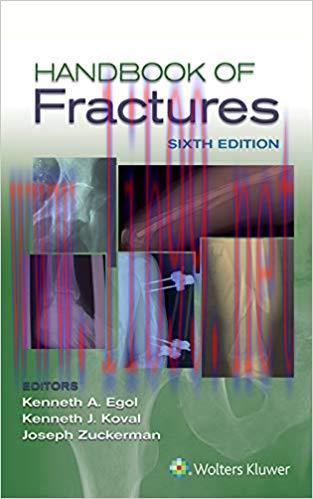 (PDF)Handbook of Fractures 6th Edition