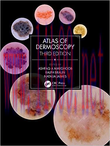 [PDF]Atlas of Dermoscopy 3rd Edition