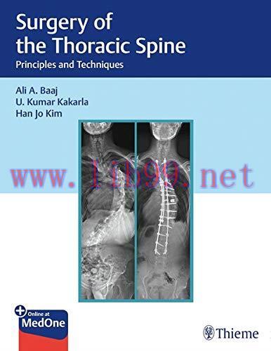 [FOX-Ebook]Surgery of the Thoracic Spine: Principles and Techniques