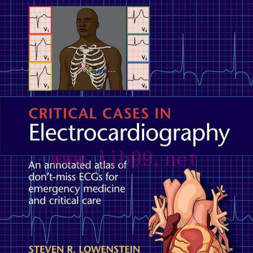 [AME]Critical Cases in Electrocardiography: An Annotated Atlas of Don’t-Miss ECGs for Emergency...
