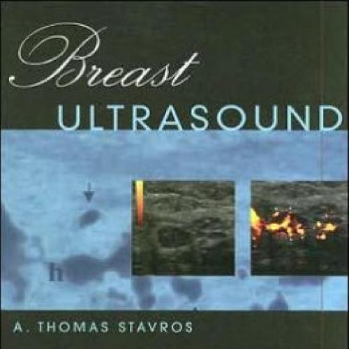 Breast Ultrasound