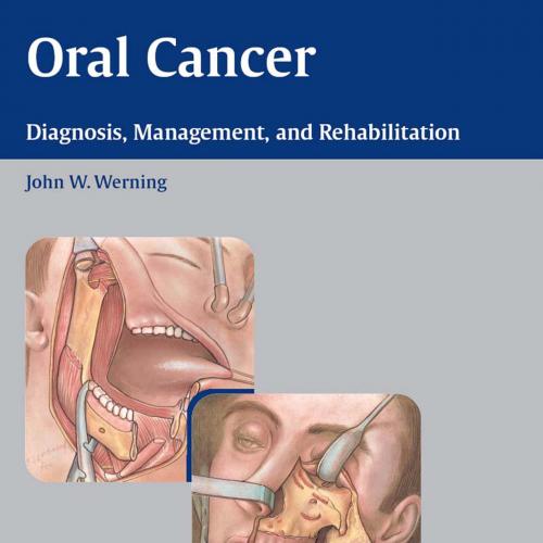 Oral cancer diagnosis, management, and rehabilitation