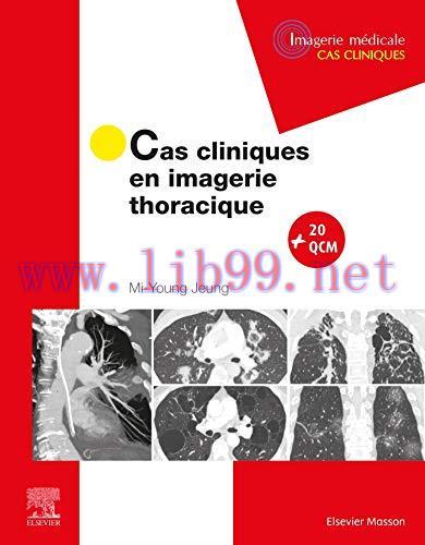 [AME]Cas cliniques en imagerie thoracique (French Edition) (EPUB)