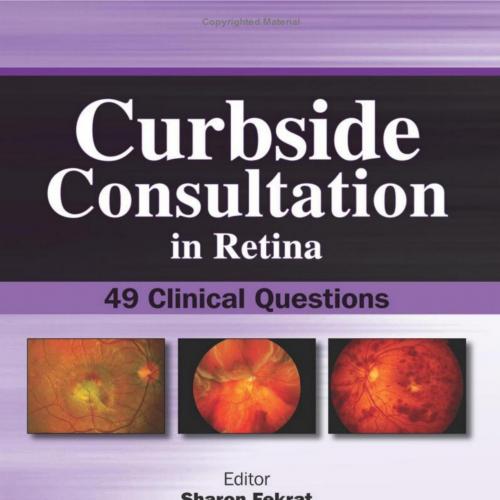 Curbside Consultation in Retina 49 Clinical Questions