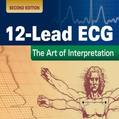 12-lead ECG The Art of Interpretation, 2nd Edition