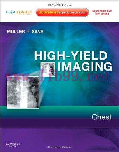 [AME]High-Yield Imaging: Chest, 1e (HIGH YIELD in Radiology) (Original PDF)