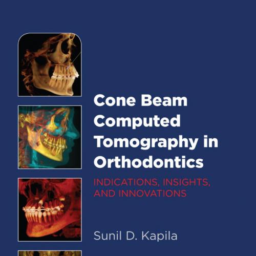 Cone Beam Computed Tomography in Orthodontics