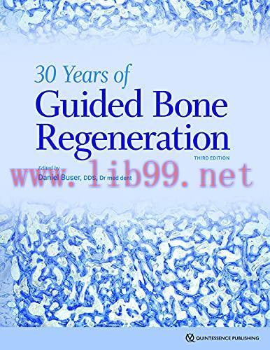 [AME]30 Years of Guided Bone Regeneration in Implant Dentistry, 3rd Edition (Original PDF)
