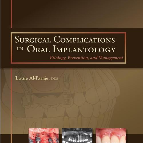 Surgical Complications in Oral Implantology_ Etiology, Prevention, and Management