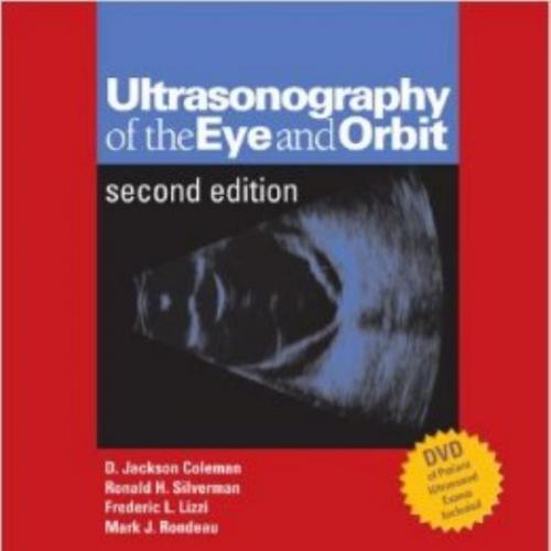 Ultrasonography of the Eye and Orbit (2nd Edition)
