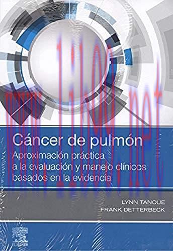 [AME]Cáncer de pulmón: Aproximación práctica a la evaluación y manejo clínicos basados en la ev...