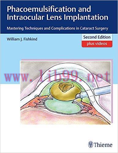 [AME]Phacoemulsification and Intraocular Lens Implantation: Mastering Techniques and Complicati...