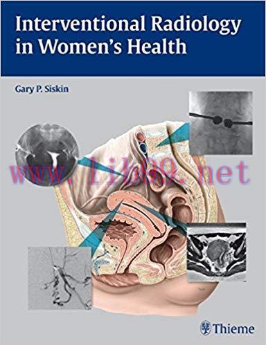 [PDF]Interventional Radiology in Women’s Health, 1e [Thieme] [2009]