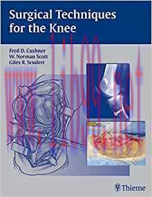 [PDF]Surgical Techniques for the Knee