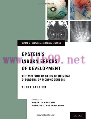 [AME]Epstein's Inborn Errors of Development: The Molecular Basis of Clinical Disorders of Morph...