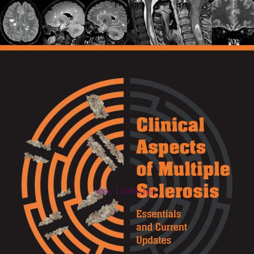 [AME]Clinical Aspects of Multiple Sclerosis Essentials and Current Update_s (Original PDF)