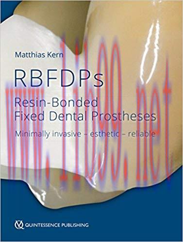 [AME]Resin-Bonded Fixed Dental Prostheses (EPUB)