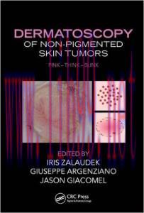 [AME]Dermatoscopy of Non-Pigmented Skin Tumors: Pink – Think – Blink