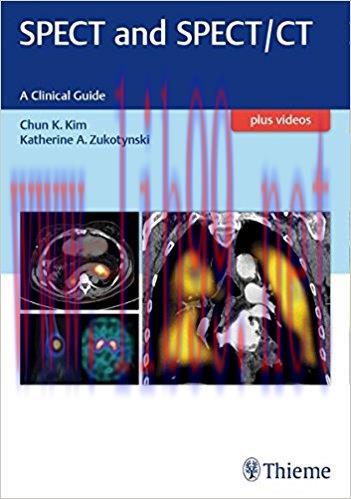 [AME]SPECT and SPECT/CT: A Clinical Guide (PDF)