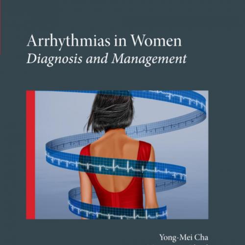 Arrhythmias in Women Diagnosis and Management