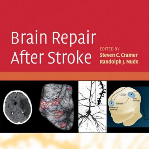 Brain Repair After Stroke