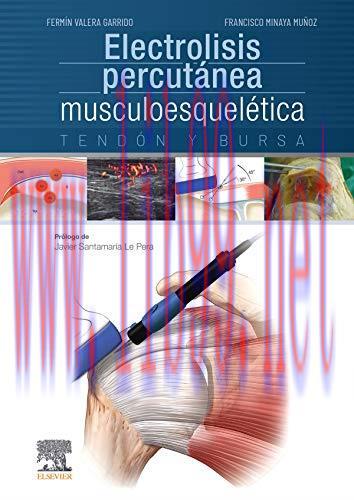 [AME]Electrolisis percutánea musculoesquelética. Tendón y bursa (Spanish Edition) (Original PDF...