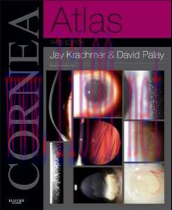 [AME]Cornea Atlas: Expert Consult – Online and Print, 3rd (Original PDF)