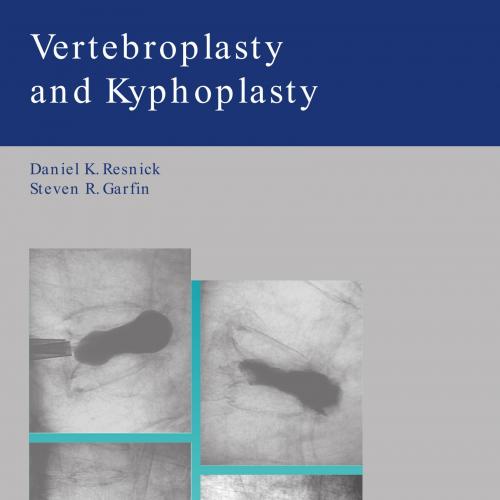 Vertebroplasty and Kyphoplasty