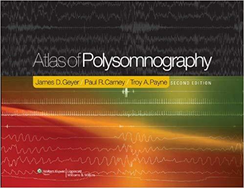Atlas of Polysomnography, 2nd Edition