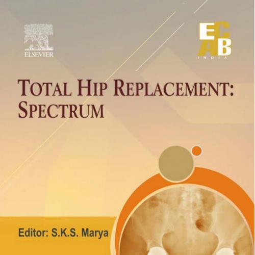 Total Hip Replacement Spectrum ECAB - Wei Zhi
