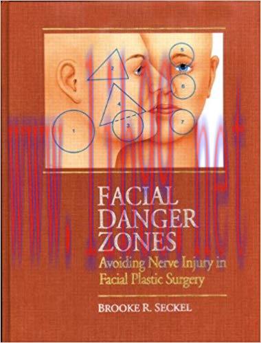 [PDF]Facial Danger Zones - Avoiding Nerve Injury in Facial Plastic Surgery 2nd Edition