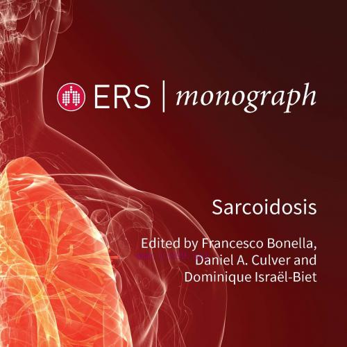 [AME]Sarcoidosis (EPUB)