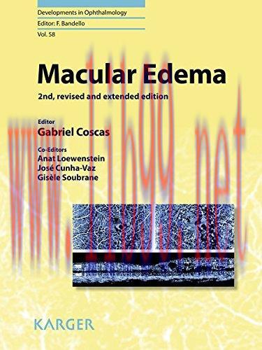 [AME]Macular Edema (Developments in Ophthalmology, Vol. 58) (PDF)