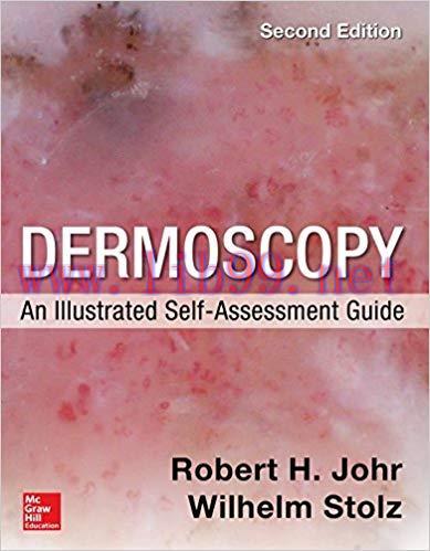 [PDF]Dermoscopy: An Illustrated Self-Assessment Guide, Second Edition