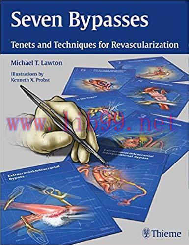 [PDF]Seven Bypasses: Tenets and Techniques for Revascularization
