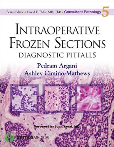 Intraoperative Frozen Sections Diagnostic Pitfalls (Consultant Pathology) 1st Edition