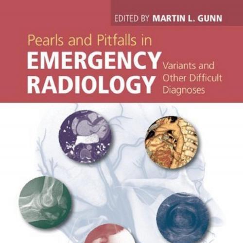 Pearls and Pitfalls in Emergency Radiology-Variants and Other Difficult Diagnoses