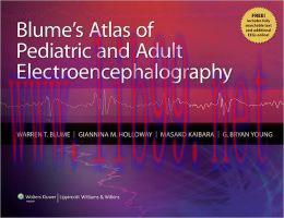 [AME]Blume’s Atlas of Pediatric and Adult Electroencephalography (ORIGINAL PDF from_ Publisher)