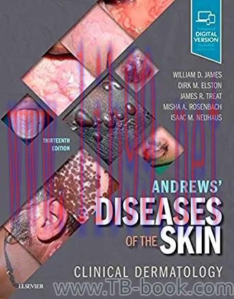 Andrews’ Diseases of the Skin E-Book: Clinical Dermatology 13th Edition by William D. James