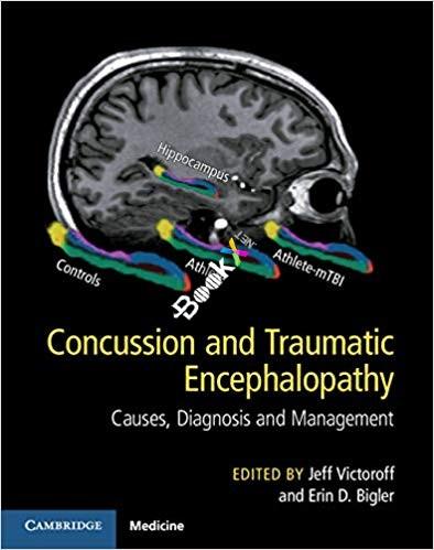 Concussion and Traumatic Encephalopathy Causes, Diagnosis, and Management
